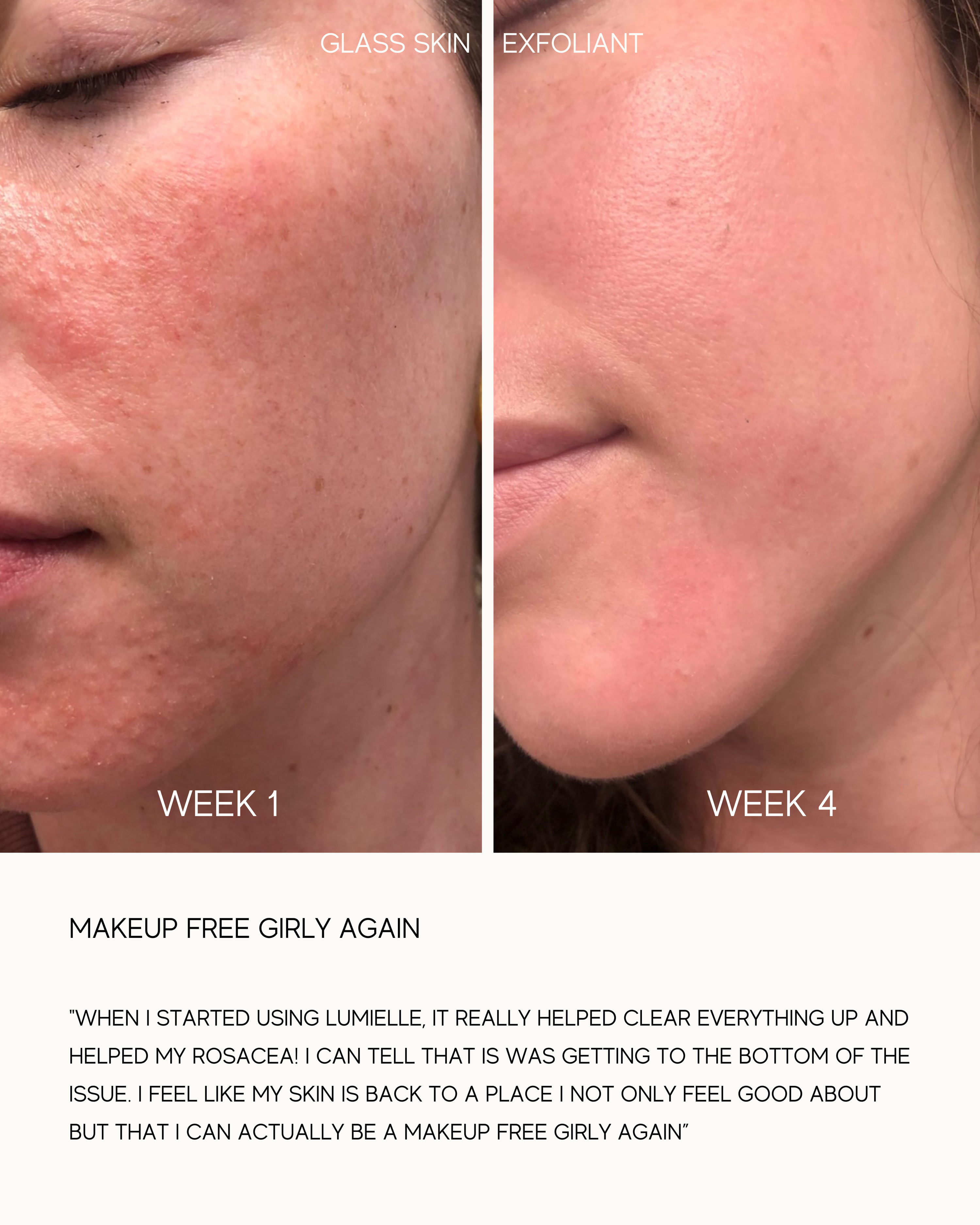 Glass Skin Liquid Exfoliant - Image 3